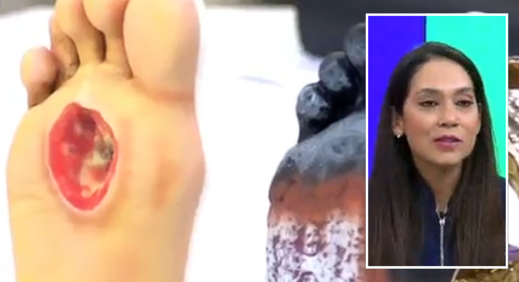 Cuidados de los pies y prevención de enfermedades: recomendaciones de especialista